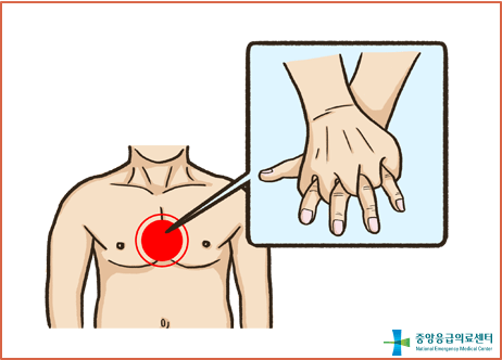 심폐소생술 흉부압박