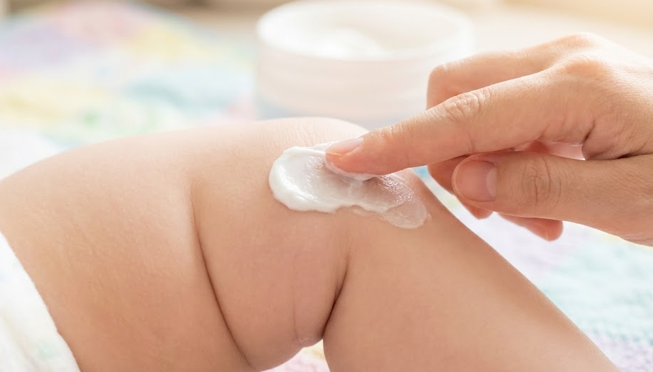 습진·지루성 등 다른 피부질환과 구분 포인트 습진·지루성 등 다른 피부질환과 구분 포인트